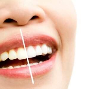 Dazzling White Teeth Whitening Pen - Easy Instant Tooth Bleaching Gel for Stain Removal & Oral Hygiene