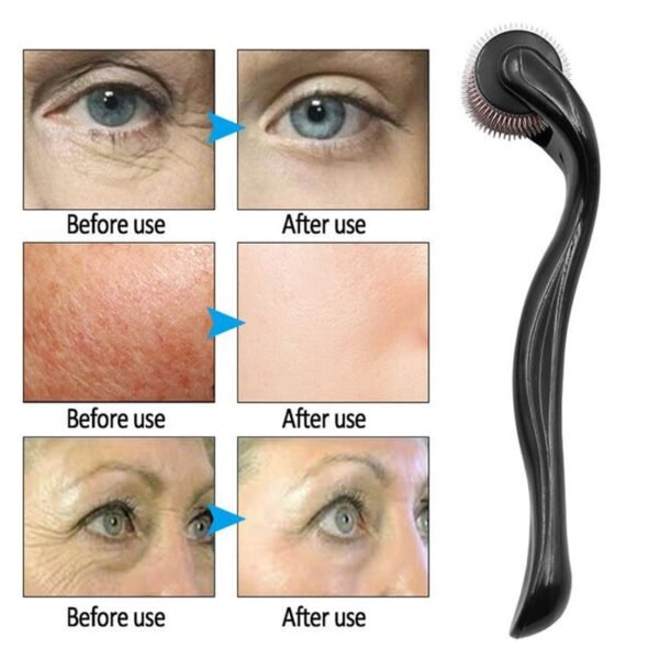 540 Derma Roller for Hair Growth Beard Facial Skin Care Micro Needle Roller Treatments - Image 4